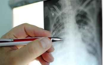 Consulta de medicina interna