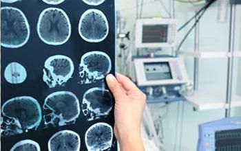 Consulta de neurocirugía