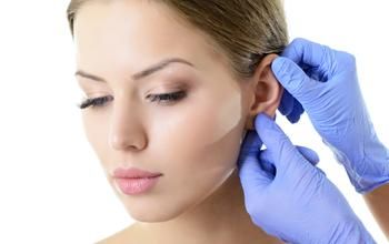 Otoplastia unilateral (cirugía de las orejas)