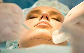 Mentoplastia simple (cirugía del mentón sin prótesis)