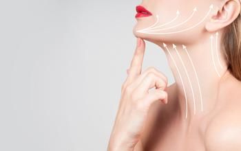 Lifting facial del tercio inferior y el cuello