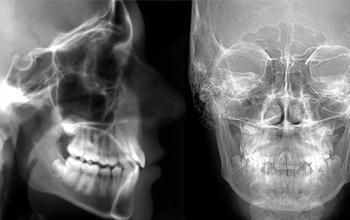 Radiografía cefalográfica lateral