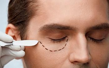 Blefaroplastia inferior (cirugía de los párpados inferiores)