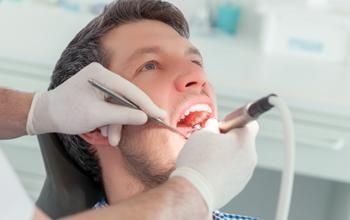 Raspado, alisado, pulido radicular por cuadrante