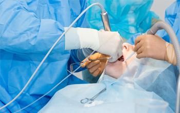 Extracción dental simple