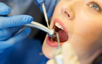 Obturación o empaste (con o sin recubrimiento pulpar)