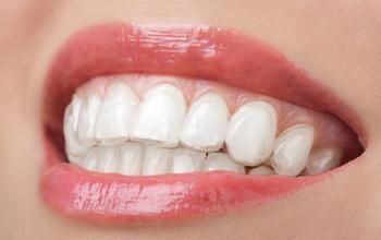 Blanqueamiento dental con férulas (por maxilar)