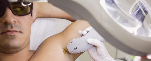 Depilación masculina (pack de 5 sesiones)